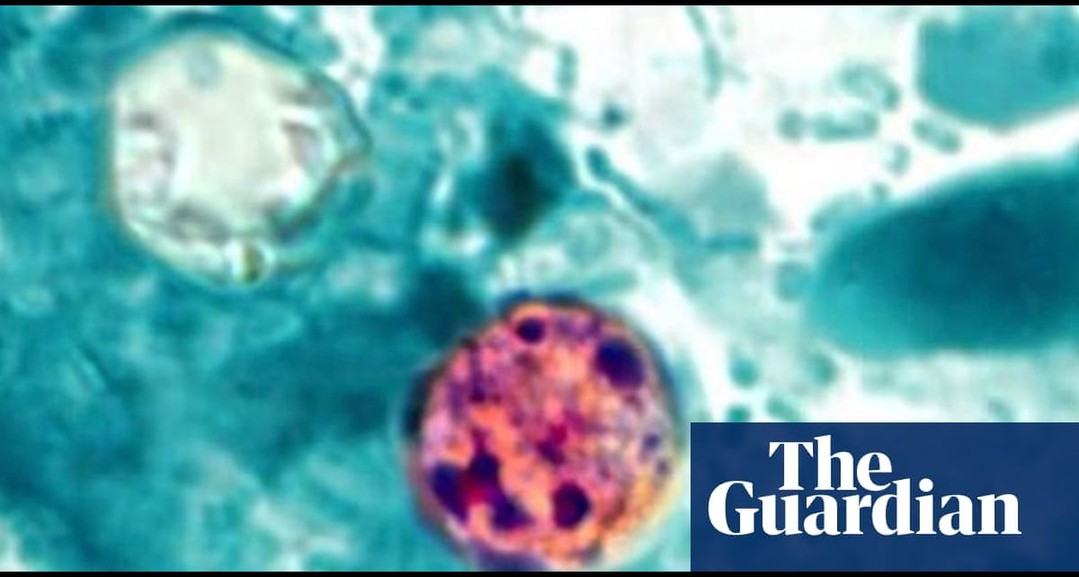 Former FDA official says US handling of cyclospora near ‘catastrophic level’…